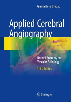 Applied Cerebral Angiography (eBook, PDF) - Bradac, Gianni Boris
