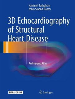 3D Echocardiography of Structural Heart Disease (eBook, PDF) - Sadeghian, Hakimeh; Savand-Roomi, Zahra