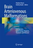 Brain Arteriovenous Malformations (eBook, PDF)