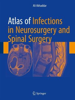 Atlas of Infections in Neurosurgery and Spinal Surgery (eBook, PDF) - Akhaddar, Ali
