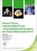Practical Perioperative Transoesophageal Echocardiography
