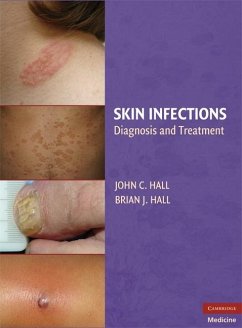 Skin Infections (eBook, ePUB)