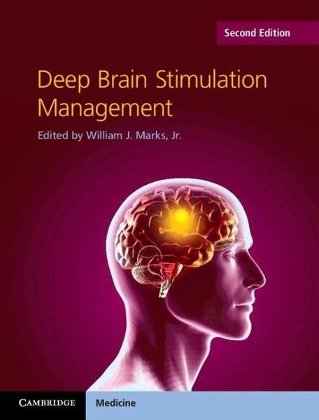 Deep Brain Stimulation Management (eBook, ePUB)