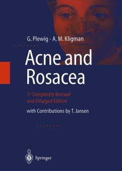 ACNE and ROSACEA (eBook, PDF) Cover ACNE and ROSACEA (eBook, PDF)