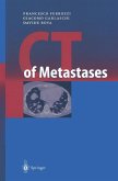 CT of Metastases (eBook, PDF)