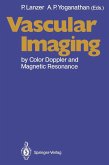 Vascular Imaging by Color Doppler and Magnetic Resonance (eBook, PDF)