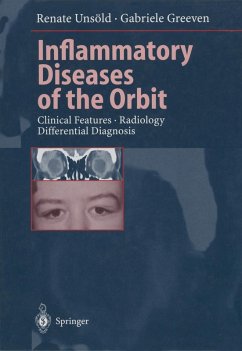 Inflammatory Diseases of the Orbit (eBook, PDF) - Unsöld, Renate; Greeven, Gabriele