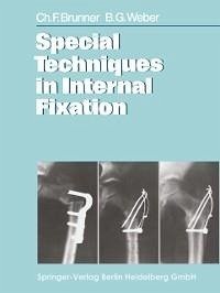 Special Techniques in Internal Fixation (eBook, PDF) - Brunner, C. F.; Weber, B. G.