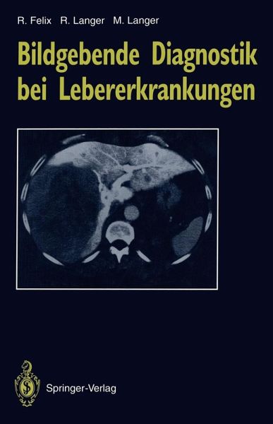 Bildgebende Diagnostik bei Lebererkrankungen (eBook, PDF)