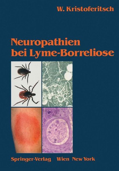 Neuropathien bei Lyme-Borreliose (eBook, PDF) Neuropathien bei Lyme-Borreliose (eBook, PDF)