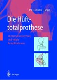 Die Hüfttotalprothese (eBook, PDF)
