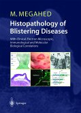 Histopathology of Blistering Diseases (eBook, PDF)