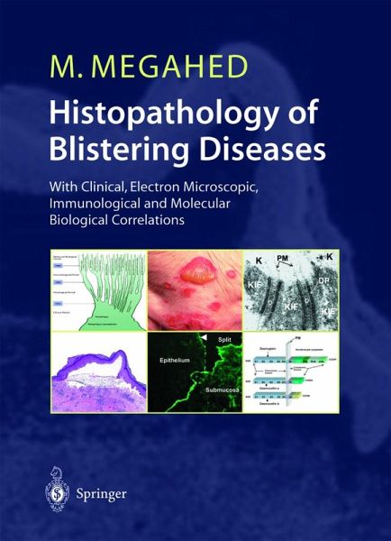 Histopathology of Blistering Diseases (eBook, PDF)