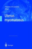 Uterus myomatosus (eBook, PDF)