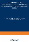 Ekzem · Dermatitis Pruritus · Prurigo · Strophulus Neurodermitis·Seborrhoisches Ekzem (eBook, PDF)