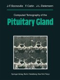 Computed Tomography of the Pituitary Gland (eBook, PDF)