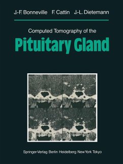 Computed Tomography of the Pituitary Gland (eBook, PDF) - Bonneville, Jean-Francois; Cattin, F.; Dietemann, Jean-Louis