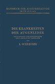 Die Krankheiten der Augenlider (eBook, PDF)