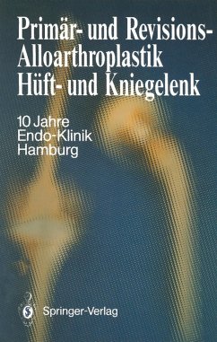 Primär- und Revisions-Alloarthroplastik Hüft- und Kniegelenk (eBook, PDF)