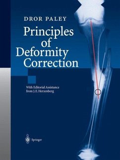 Principles of Deformity Correction (eBook, PDF) - Paley, Dror