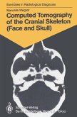 Computed Tomography of the Cranial Skeleton (Face and Skull) (eBook, PDF)