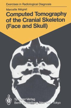 Cover Computed Tomography of the Cranial Skeleton (Face and Skull) (eBook, PDF)