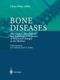 Bone Diseases (eBook, PDF)