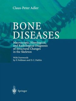 Bone Diseases (eBook, PDF) - Adler, Claus-Peter