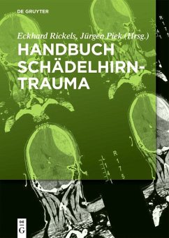 Cover Handbuch Schädelhirntrauma (eBook, ePUB)