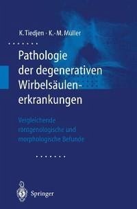 Pathologie der degenerativen Wirbelsäulenerkrankungen (eBook, PDF) - Tiedjen, Kay; Müller, Klaus-Michael