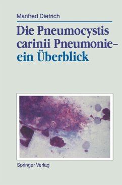Cover Die Pneumocystis carinii Pneumonie- ein Überblick (eBook, PDF)