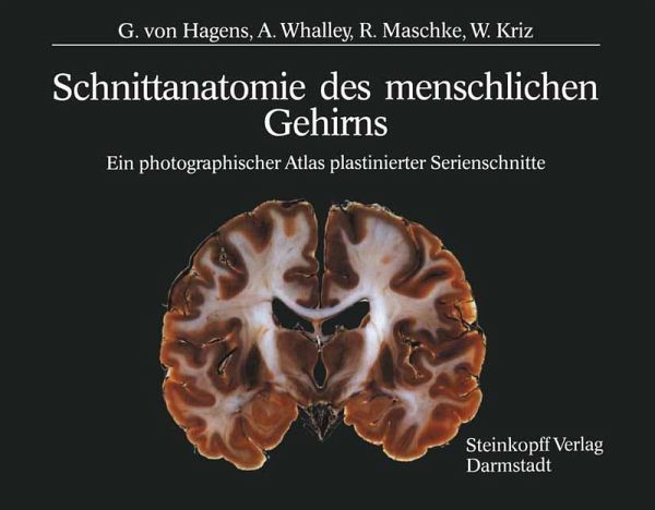Schnittanatomie des menschlichen Gehirns (eBook, PDF) Schnittanatomie des menschlichen Gehirns (eBook, PDF)