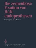 Die zementlose Fixation von Hüftendoprothesen (eBook, PDF)