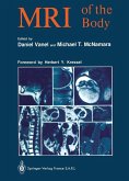 MRI of the Body (eBook, PDF)