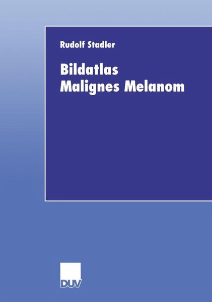 Bildatlas Malignes Melanom (eBook, PDF)