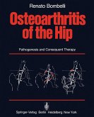 Osteoarthritis of the Hip (eBook, PDF) Osteoarthritis of the Hip (eBook, PDF)