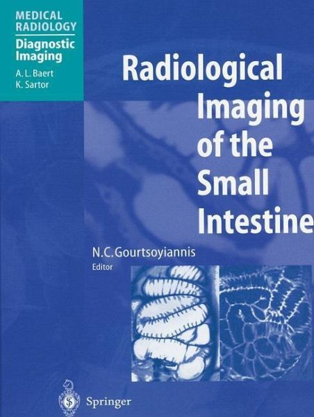 Radiological Imaging of the Small Intestine (eBook, PDF) Radiological Imaging of the Small Intestine (eBook, PDF)
