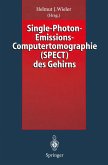 Single-Photon-Emissions-Computertomographie (SPECT) des Gehirns (eBook, PDF)
