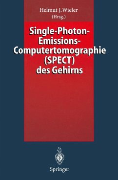 Single-Photon-Emissions-Computertomographie (SPECT) des Gehirns (eBook, PDF)
