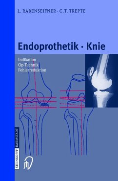 Endoprothetik Knie (eBook, PDF) - Rabenseifner, L.; Trepte, C.