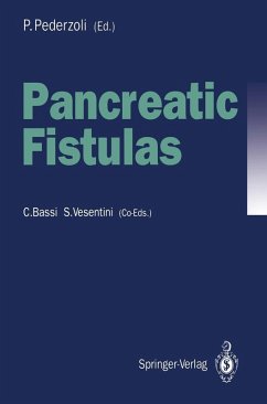 Cover Pancreatic Fistulas (eBook, PDF)