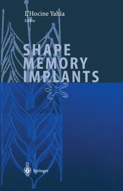 Shape Memory Implants (eBook, PDF)