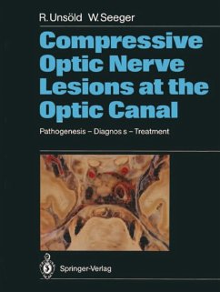 Cover Compressive Optic Nerve Lesions at the Optic Canal (eBook, PDF)