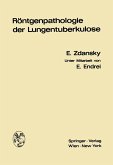 Röntgenpathologie der Lungentuberkulose (eBook, PDF)