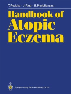 Handbook of Atopic Eczema (eBook, PDF)