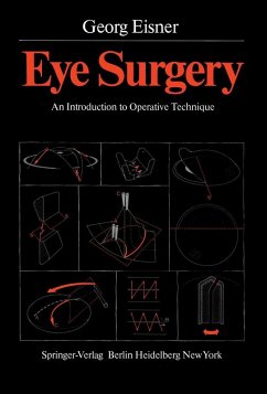 Cover Eye Surgery (eBook, PDF)