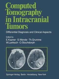 Computed Tomography in Intracranial Tumors (eBook, PDF) - Bradac, G. B.; Kazner, E.; Kretzschmar, K.; Lanksch, W.; Meese, W.; Schramm, J.; Steinhoff, H.; Stochdorph, O.; Wende, S.; Büll, U.; Fahlbusch, R.; Grumme, Th.