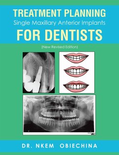 Treatment Planning Single Maxillary Anterior Implants for Dentists (eBook, ePUB)