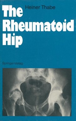 The Rheumatoid Hip (eBook, PDF) - Thabe, Heiner