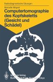 Computertomographie des Kopfskeletts (Gesicht und Schädel) (eBook, PDF)